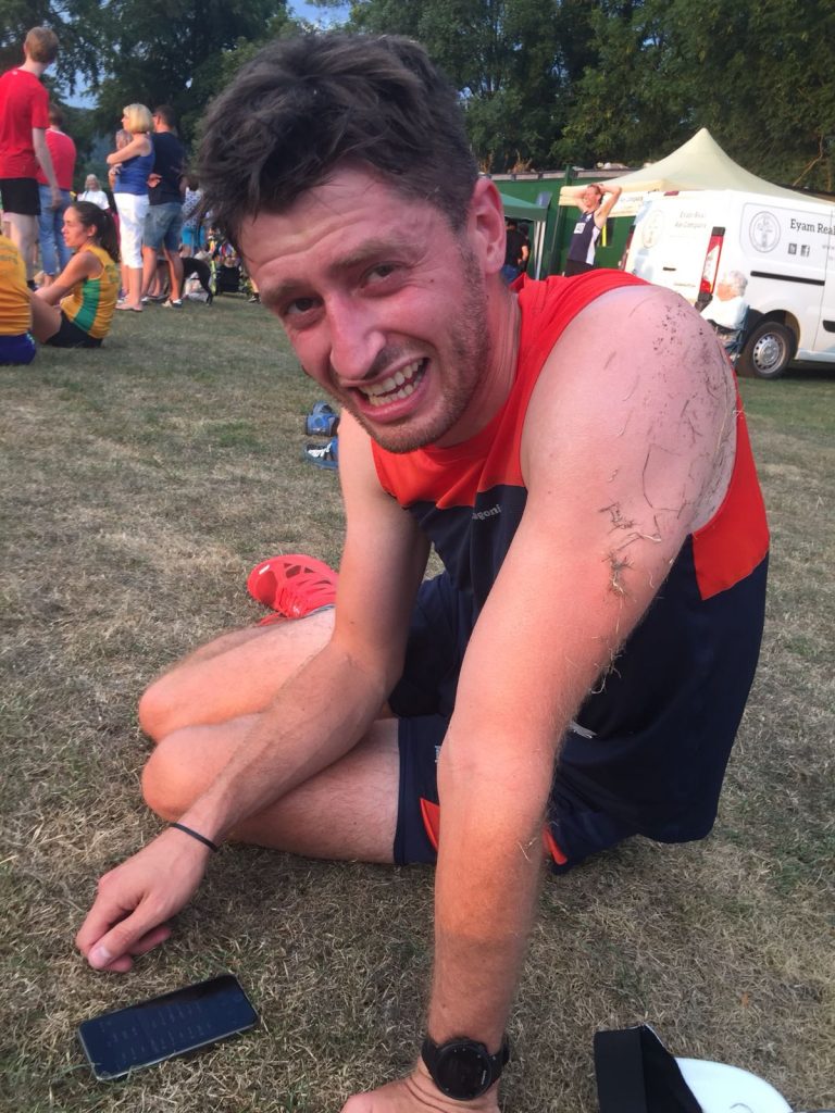 Feeling the burn after the race